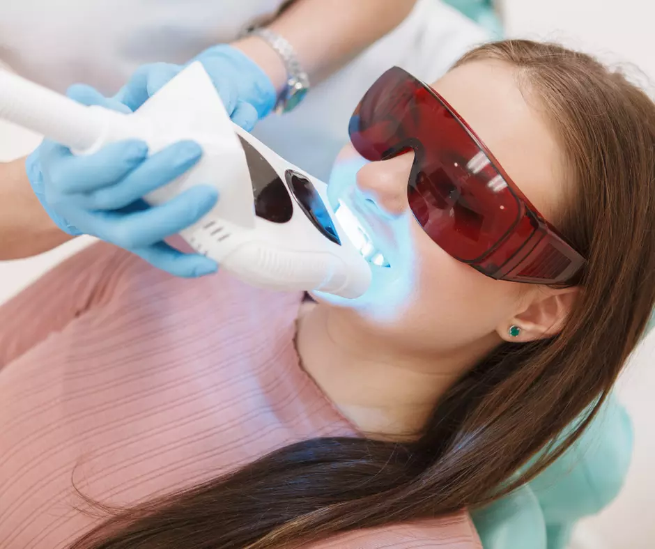 Up to 33% Off on Teeth Whitening at Siren Gems - Primary Image