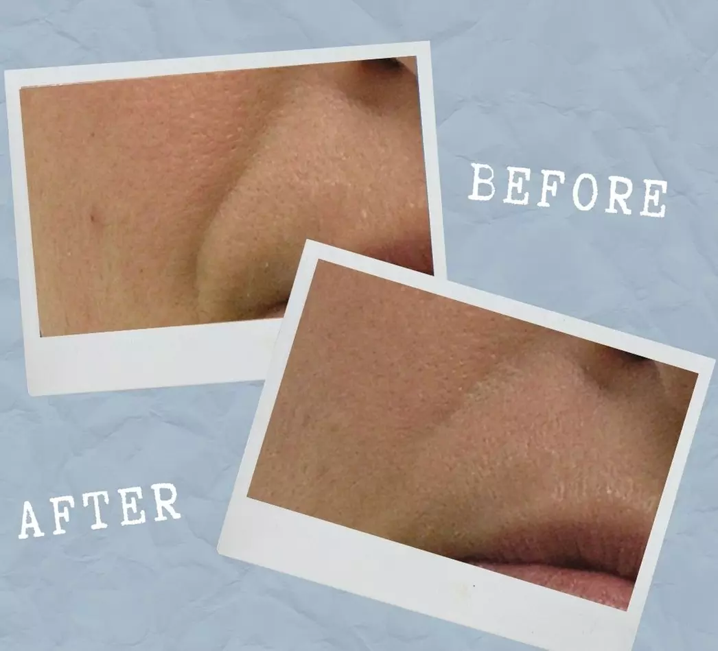 Experience the Ultimate Refresh at Bb Lash Studios 23: Enjoy a Mini HydraFacial! (Up to 35% Off) - Second Medium