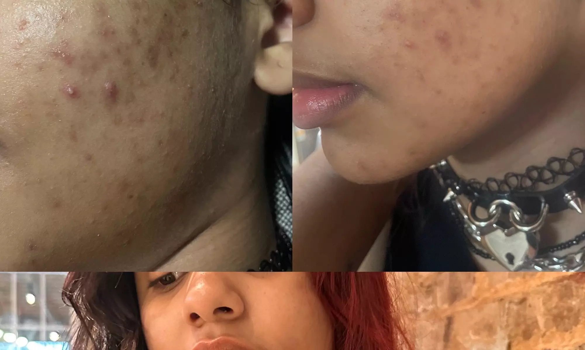 Experience Full Face Extractions with RF Facial at OBNoxious Beauty in Buckhead, up to 50% off - Primary Image