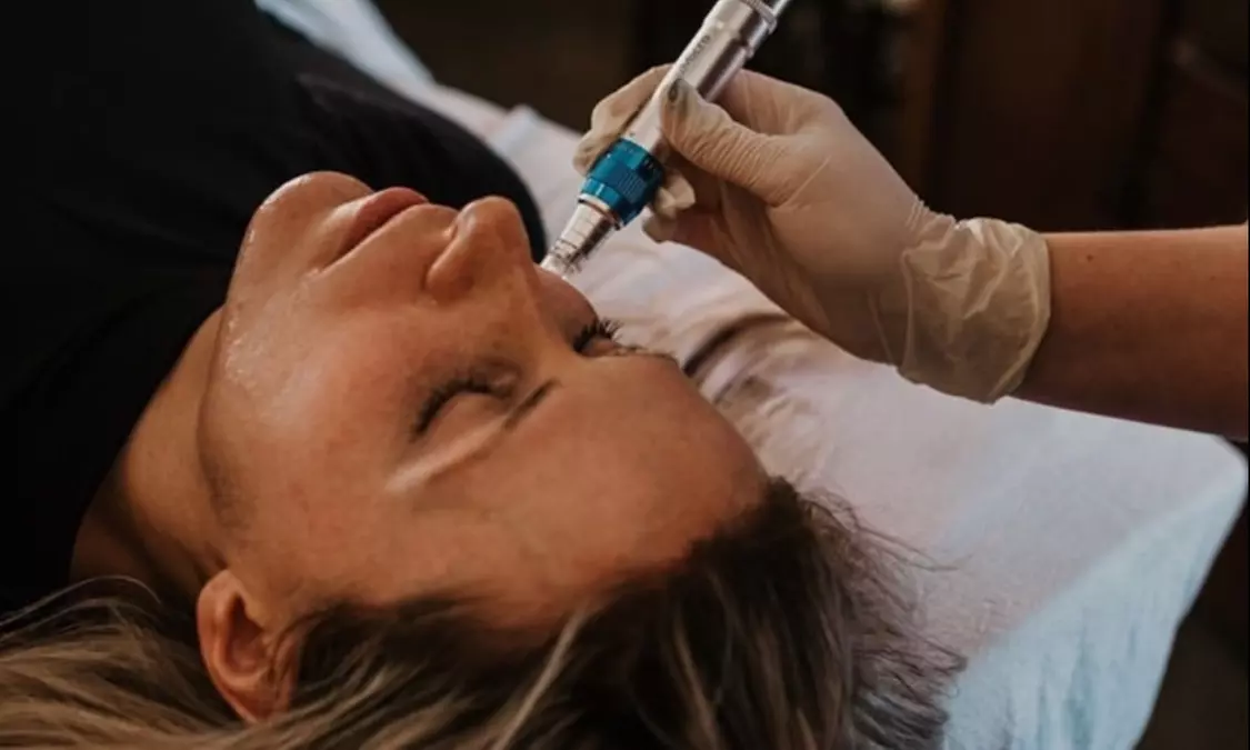 Up to 44% Off on Acupuncture at Healing Haven Acupuncture Llc - Second Medium