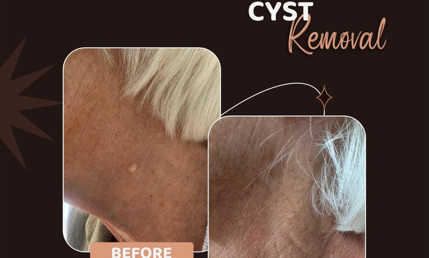 Image 6: Radiant Skin Transformation With Hydrafacial