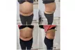 Up to 46% Off on Ultrasonic Fat Reduction at Serenity Body Sculpting and Spa - Second Medium