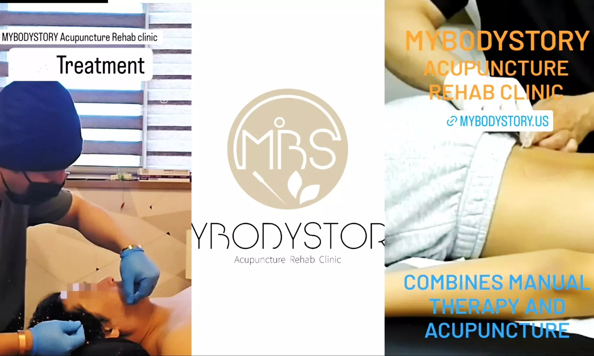 Revitalize with One or Two Acupuncture Sessions and Shockwaves