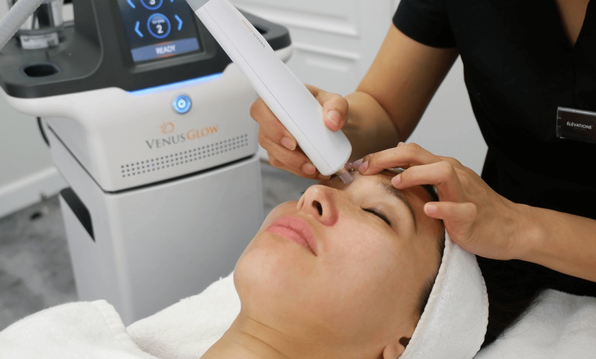 Image 1: One-Hour Glow Gold Hydrofacial Package at Venus Beauty