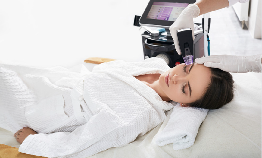 Image 1: Up to 81% Off on RF Micro-Needling at Isles Of Beauty Med Spa