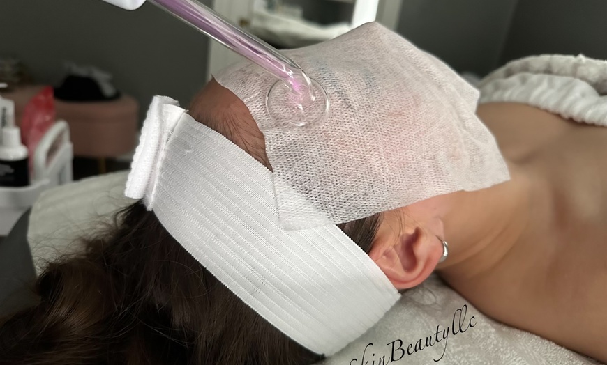 Image 1: 60 Minute Facial Treatments at Bare Skin Beauty