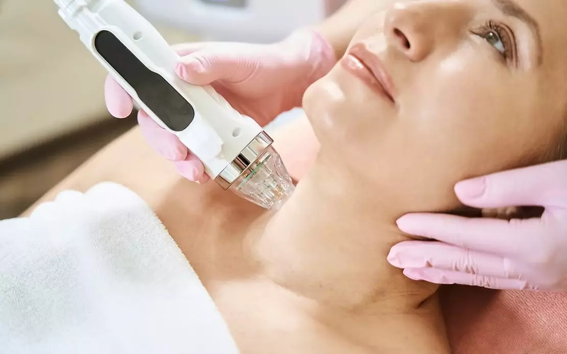 Enjoy SkynFirm RF Microneedling and HydraGlow at Eclat Skin Confidence Spa with options for face, neck, and chest up to 55% off
