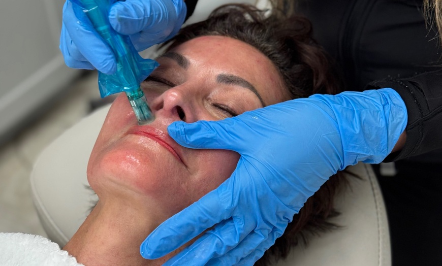 Image 2: Up to 63% Off on Micro-Needling at R3 Anti Aging & Medspa