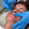 Image 2: Up to 63% Off on Micro-Needling at R3 Anti Aging & Medspa