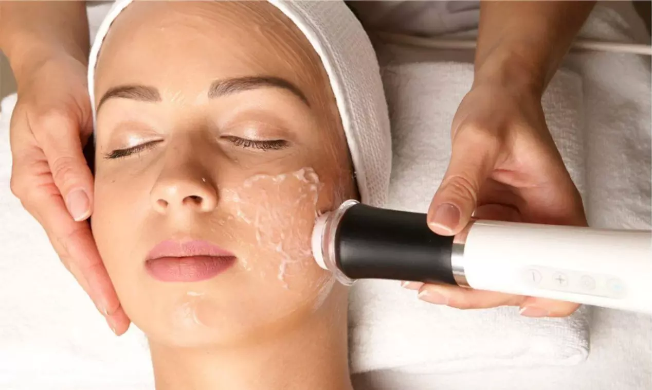 Up to 60% Off on  at Luna Med Spa - Burlington - Second Medium