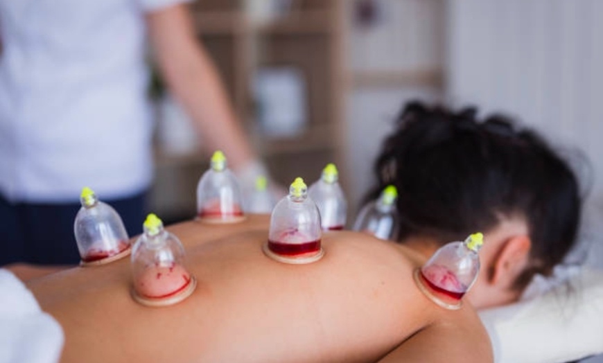 Image 2: Revitalize Your Body: One Cupping Session with Consultation