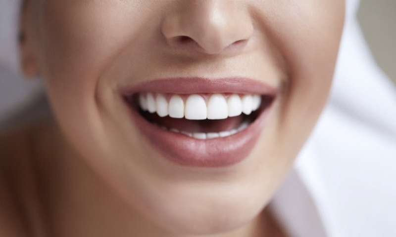 Brighten Your Smile with Teeth Whitening Treatments