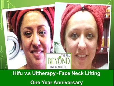 Ultra-Lift Body Detox/Sculpting for 2 sessions for 1 area 50% off - Beyond The Spa