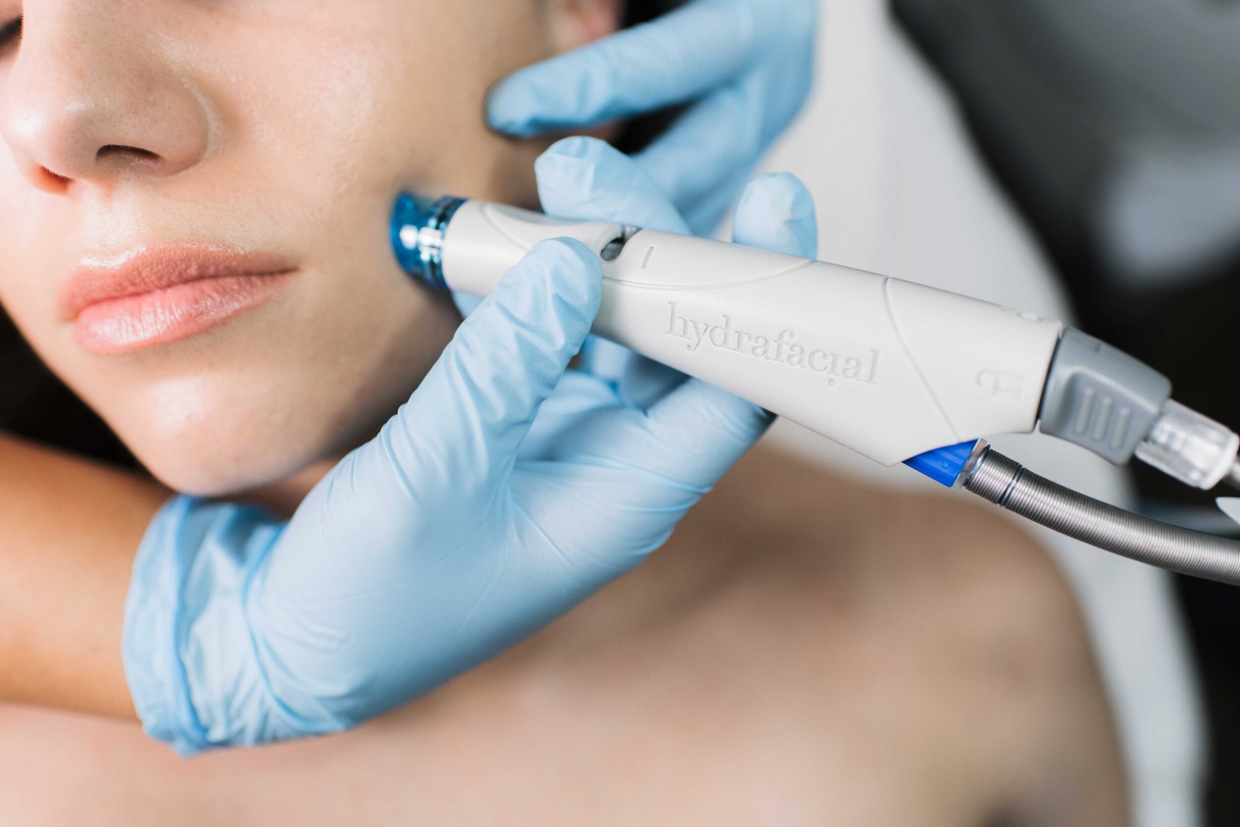 Hydrafacial Plus or Signature Hydrafacial for Glowing Skin