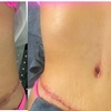 Image 2: Post-Op Lymphatic Massage at Post op curves(Up to 60% Off)