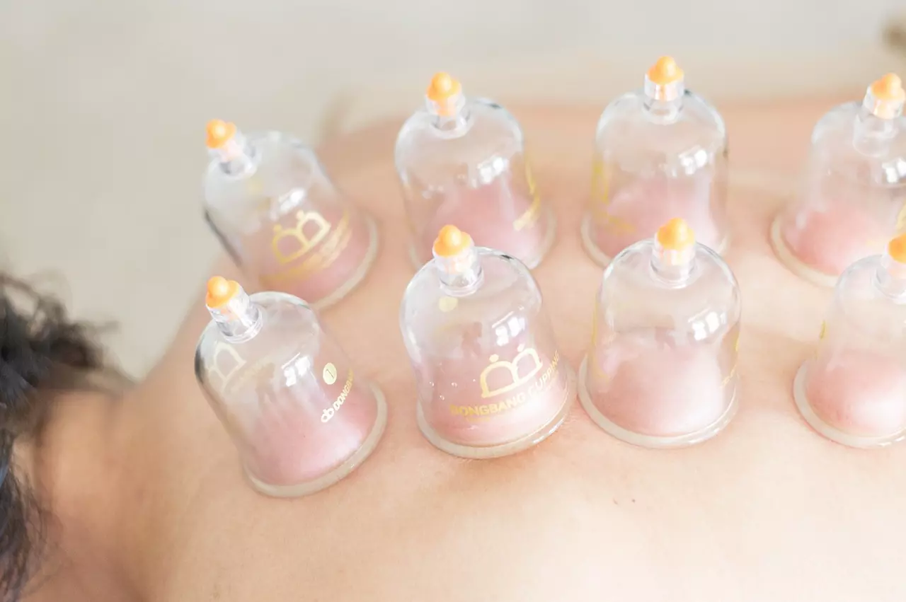 Up to 56% Off on Acupuncture at Everyday Acupuncture