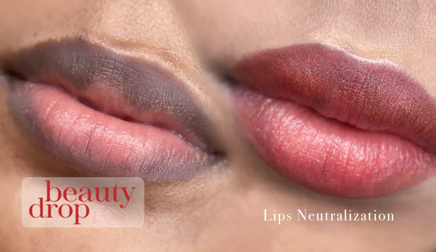 Up to 40% Off on Lip Enhancement at Beauty Drop TX - Second Medium