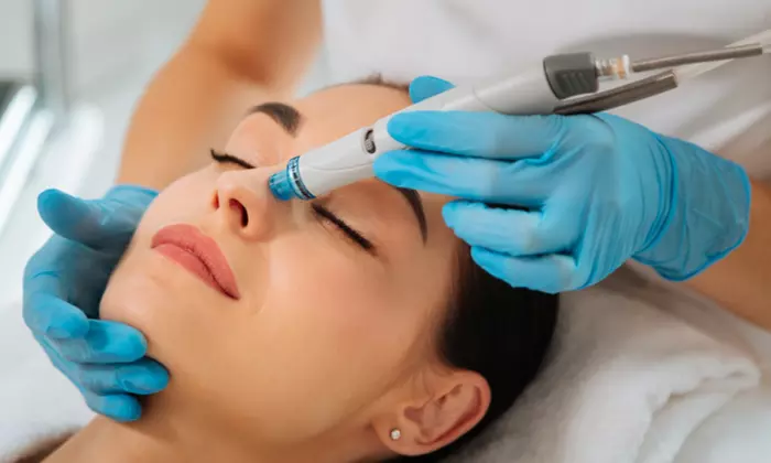 Up to 66% Off on HydraFacial, Microneedling, CO2 Laser Light Peel at Everest Medspa - Primary Image
