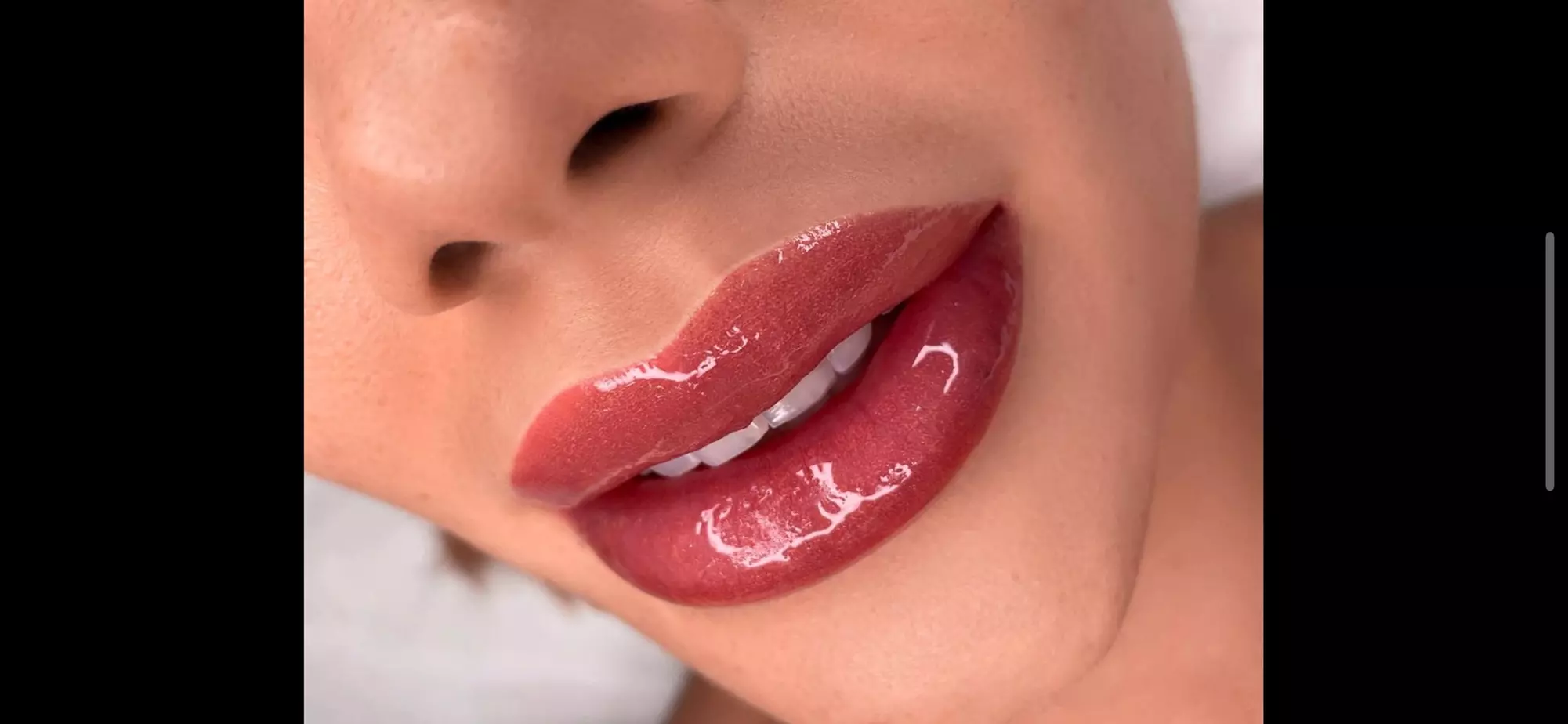 Up to 43% Off on Lip Enhancement at Face It Studio - Primary Image