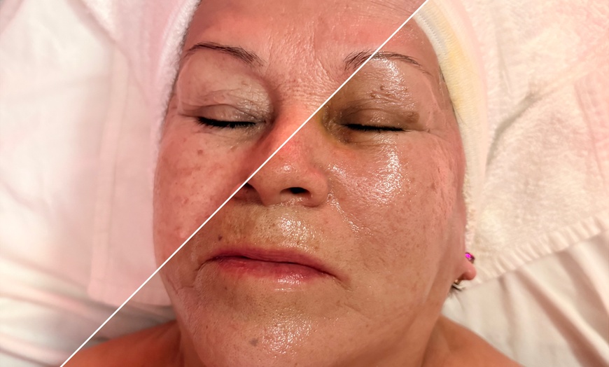 Image 7: Up to 40% Off on Facial at Skin Luxe Co