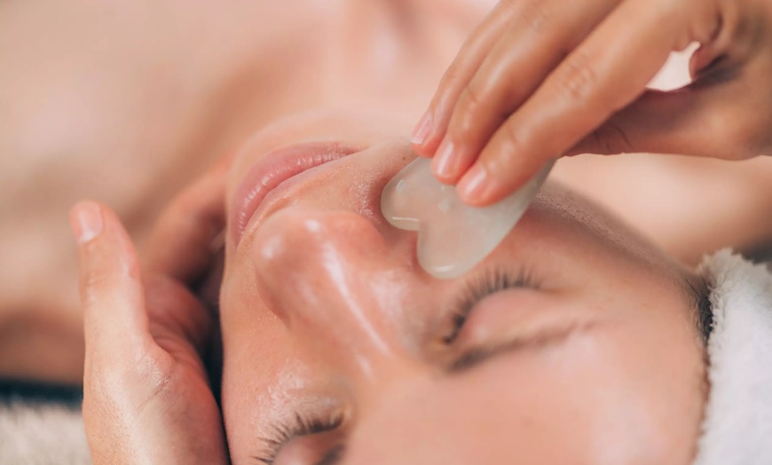 Image 4: Experience Acupuncture and Cupping for Holistic Wellness