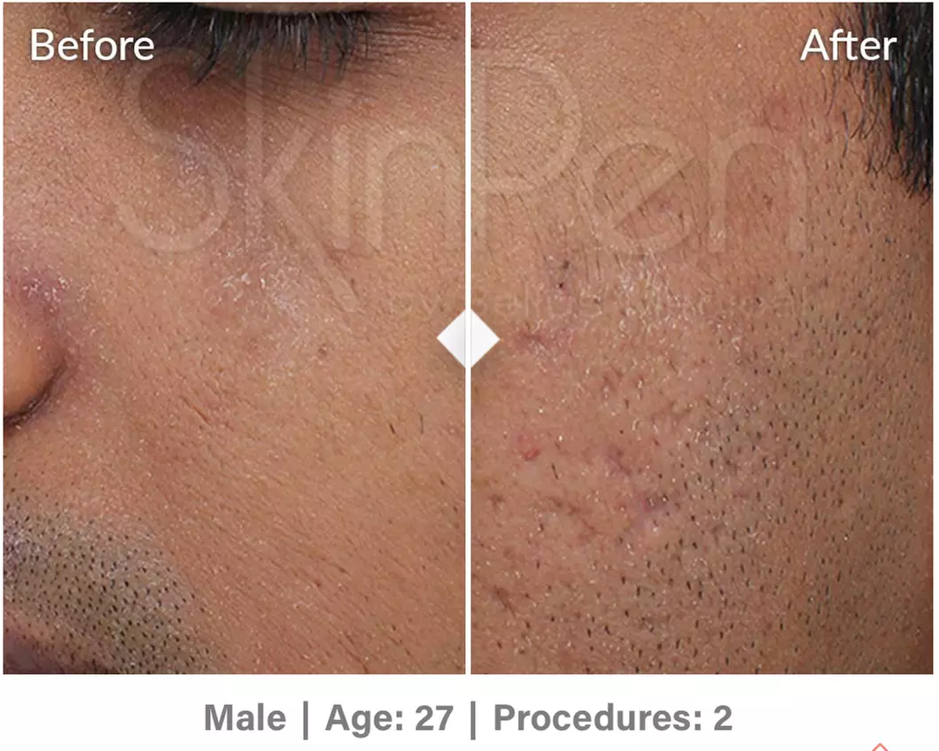 Up to 49% Off on Spa/Salon Beauty Treatments (Services)