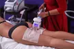 One or Three Sessions of Cryolipolysis (One or Two Cups) at London Body Centre - Second Medium