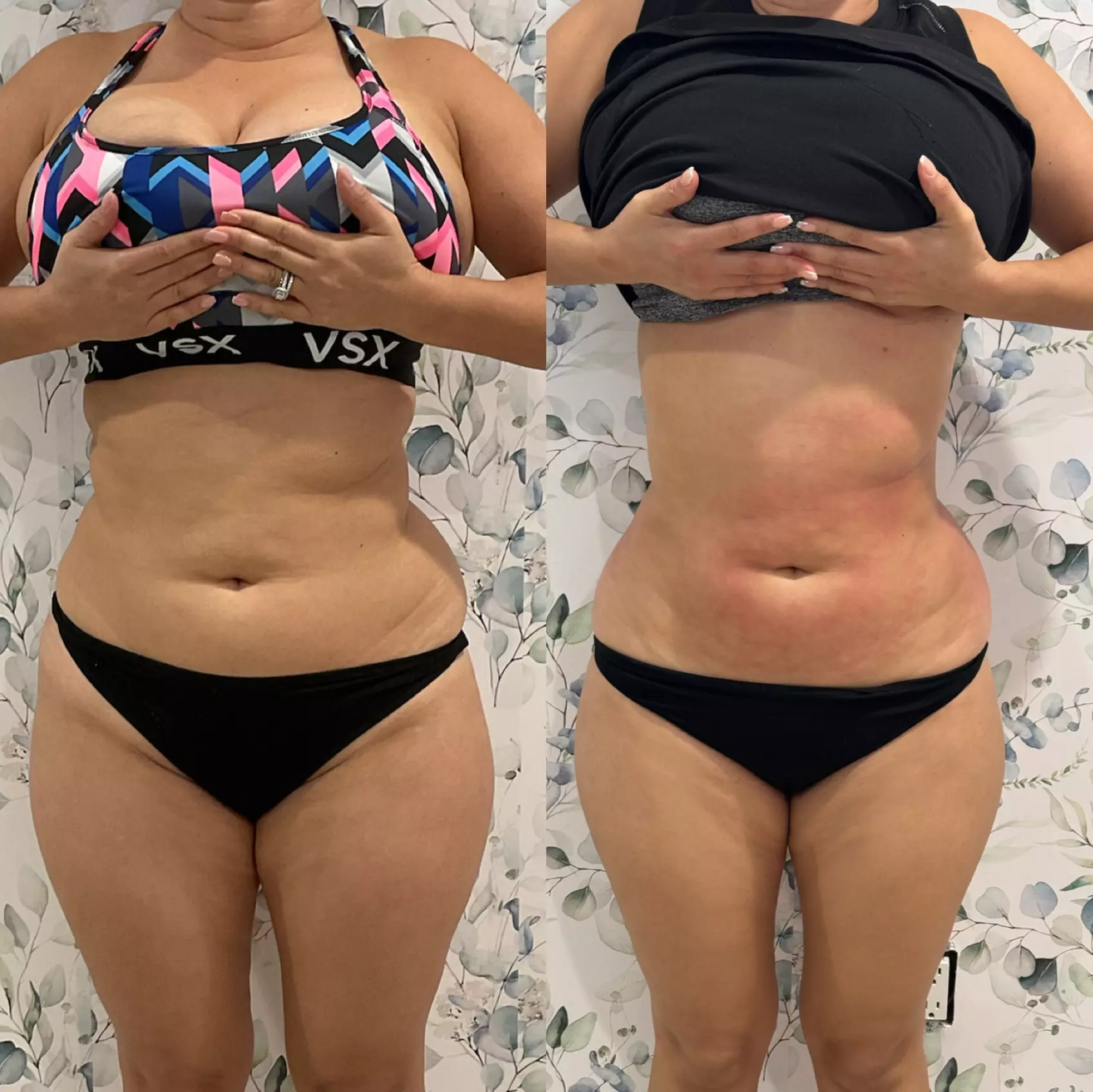 Up to 51% Off on Ultrasonic Fat Reduction at Soleil med spa