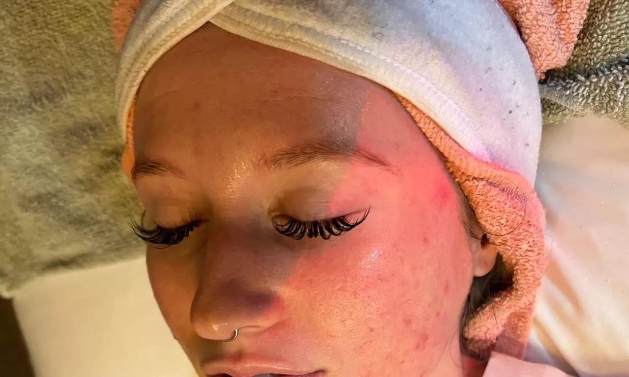 Up to 42% Off on Facial at Cloud 9 Esthetics - Primary Image