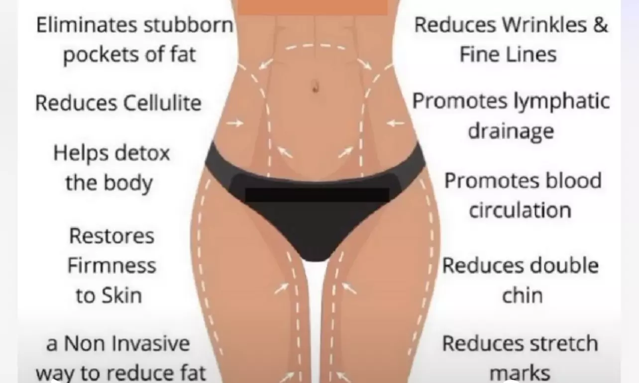 Up to 10% Off on Ultrasonic Fat Reduction at CloZet Therapy & Beauty Body Sculpting and Contour - Second Medium