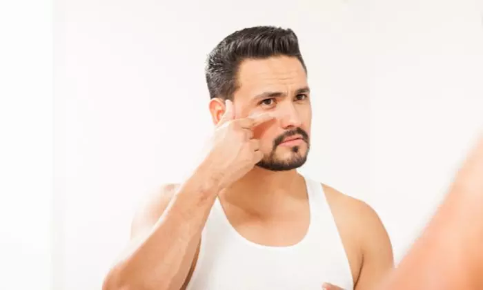 Up to 57% Off on Dark Circle / Under Eye Treatment at London Body Centre - Primary Image