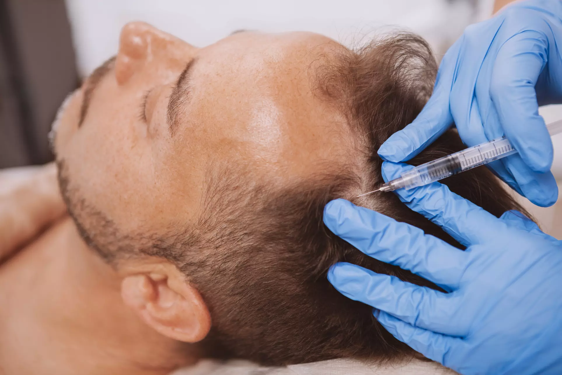Up to 52% Off on Hair Restoration - Non-Surgical at Kaizen MediSpa - Primary Image
