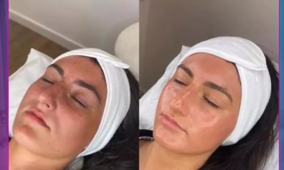 Facial - Anti-Aging at Ami Ami Nails Dubai - Primary Image