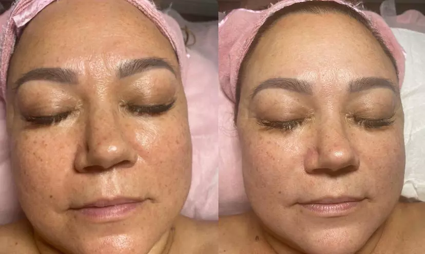 Explore Beauty Queen Spa's microdermabrasion facials, lash extensions, and hydrating treatments with up to 30% off. - Second Medium