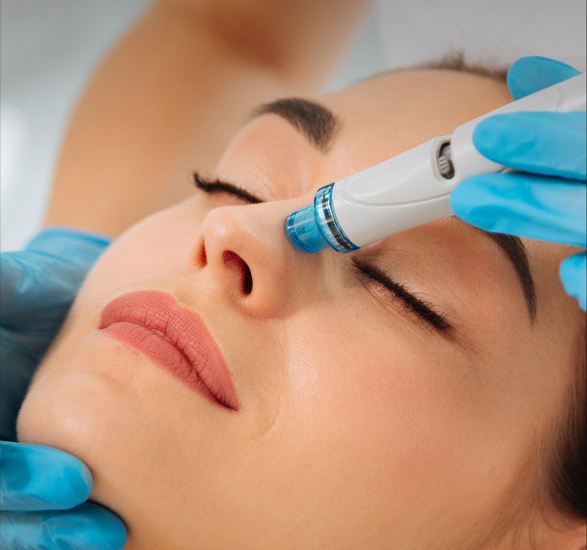 Up to 50% Off on HydraFacial at MA Body Design & Facial