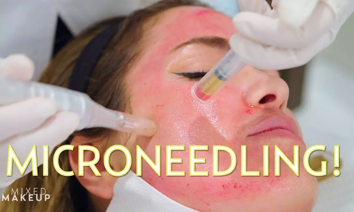 Up to 60% Off on Facelift - Non-Surgical at PBS Spa