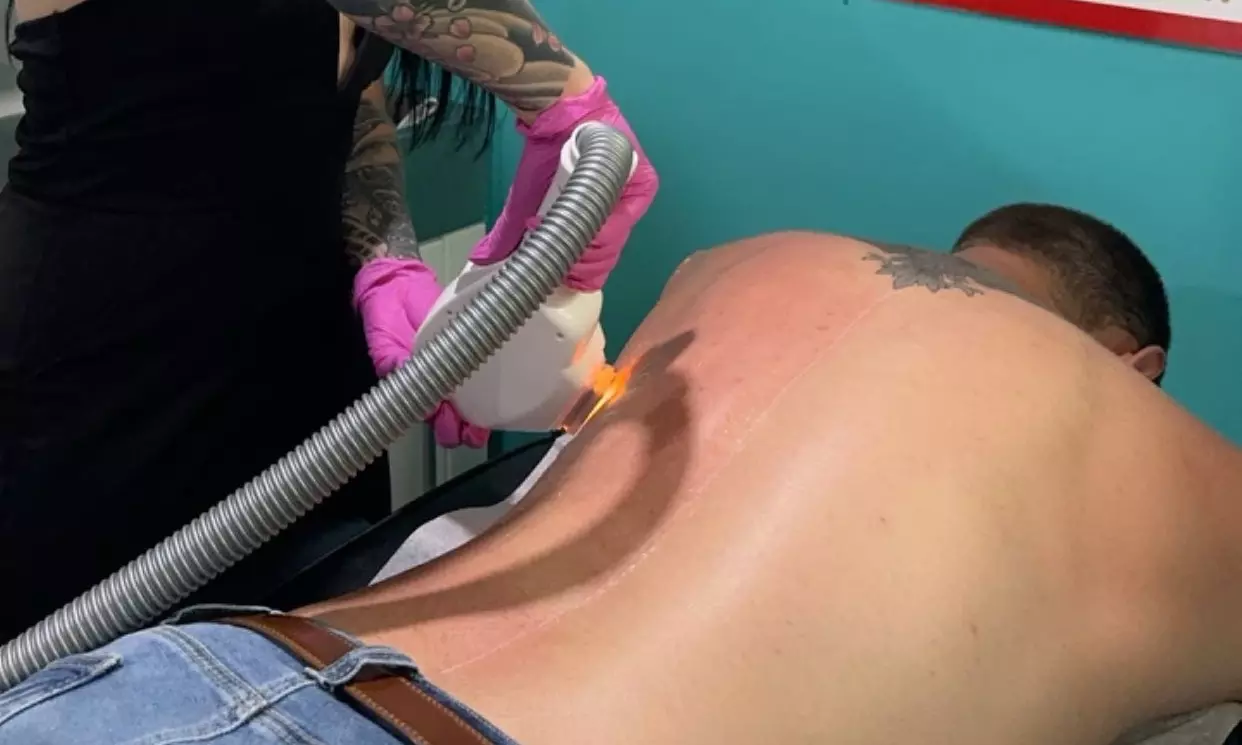 Full Body IPL Hair Removal at Boss Beauty Laser and Wellness Clinic