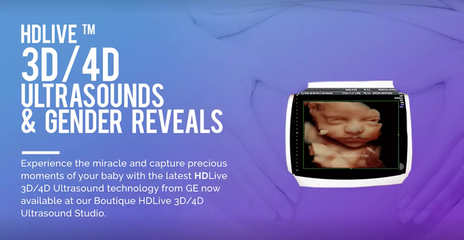 Up to 52% Off on Ultrasound - 3D / 4D at Prenatal Ultrasound HDLive 3D/4D Ultrasound Studio - Second Medium