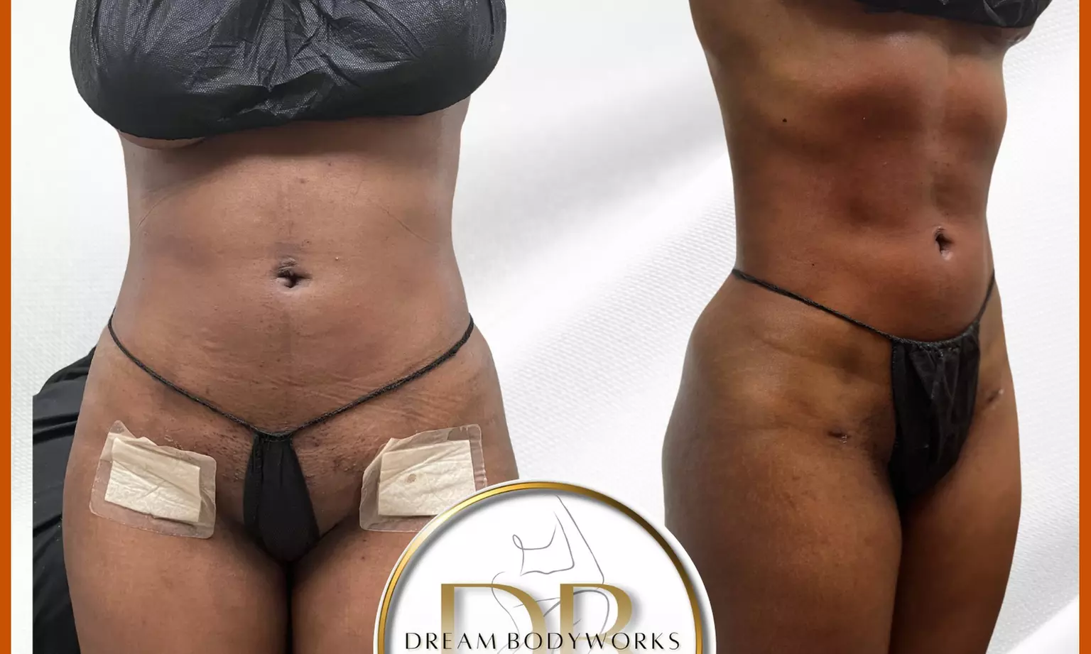Up to 53% Off on Lymphatic Drainage Massage at Dream Bodyworks Llc