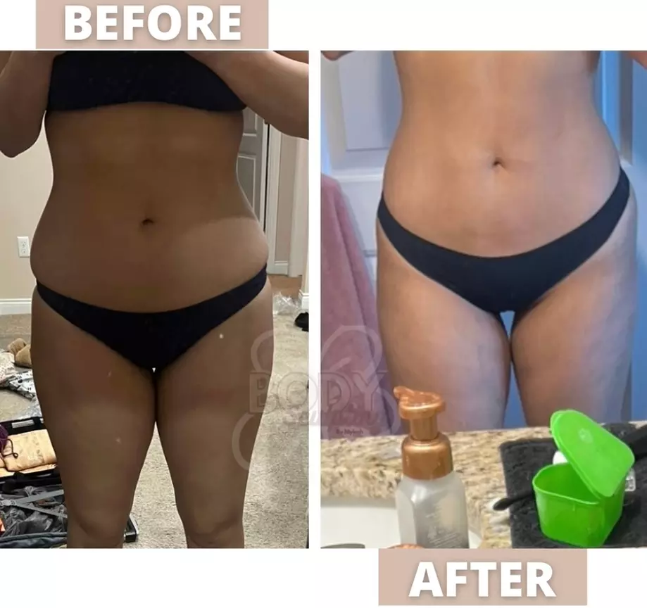 Up to 46% Off on Cavitation at Body Sculpting By Mykah - Primary Image
