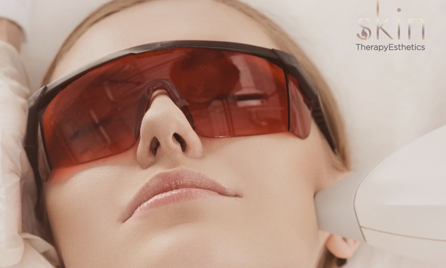 Image 1: Rejuvenate with One or Three IPL Photofacials for Radiant Skin

