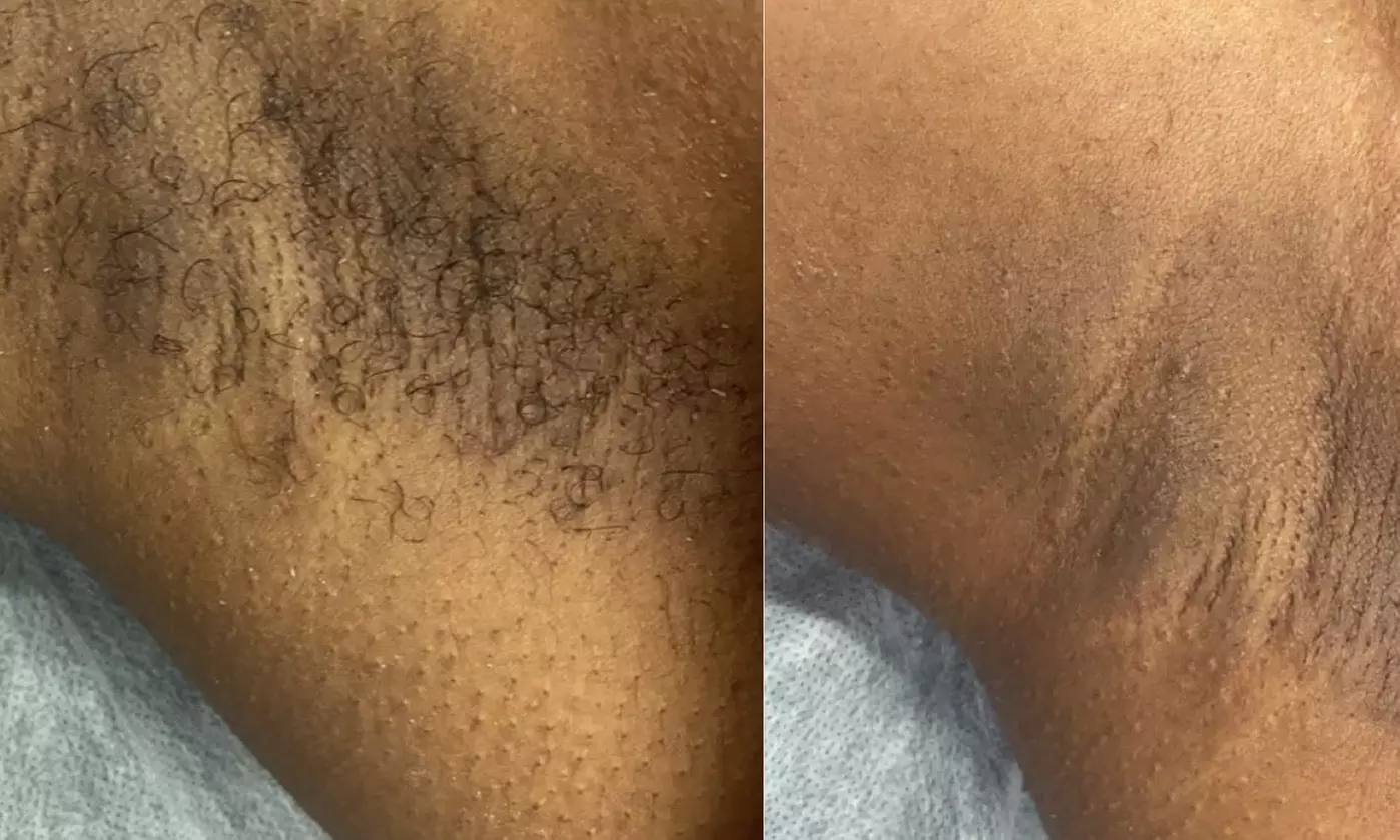 Up to 47% Off on Waxing - Underarm at Divine Gloww - Primary Image