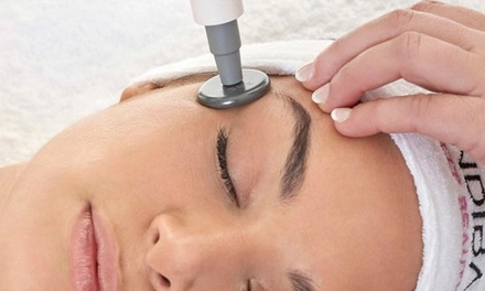 Tratamiento facial con radiofrecuencia de Indiba Edna - Clínica Novastetic Barrio de Salamanca