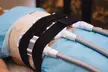 Transform Your Body with Cryotherapy, Acupuncture and More at Tian Chao Herbs & Acupuncture (Up to 45% Off) - Second Medium