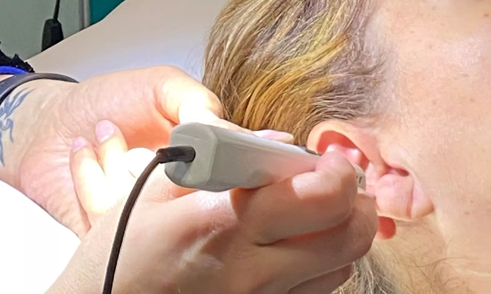 Up to 40% Off on Acupuncture at Visionary Health Educational Medical Clinic - Primary Image
