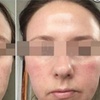 Image 2: Advanced Chemical Peel or 2-Hour Anti-Aging Facial at RISE Skin Spa