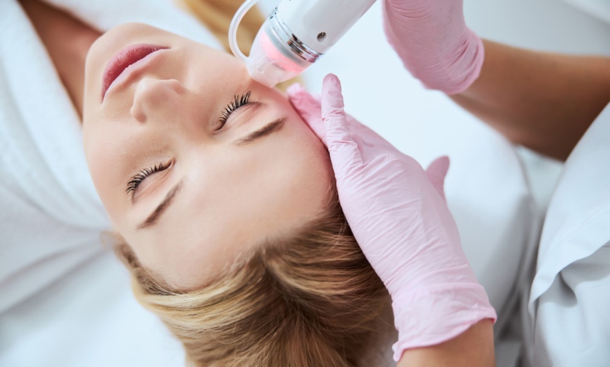 Image 1: Up to 55% Off on Micro-Needling at UK Aesthetics Lounge