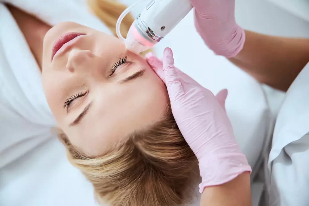 Up to 55% Off on Micro-Needling at UK Aesthetics Lounge
