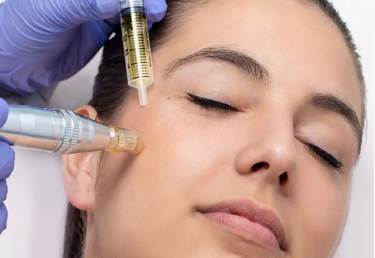 Up to 71% Off on Micro-Needling at Elbrow bar