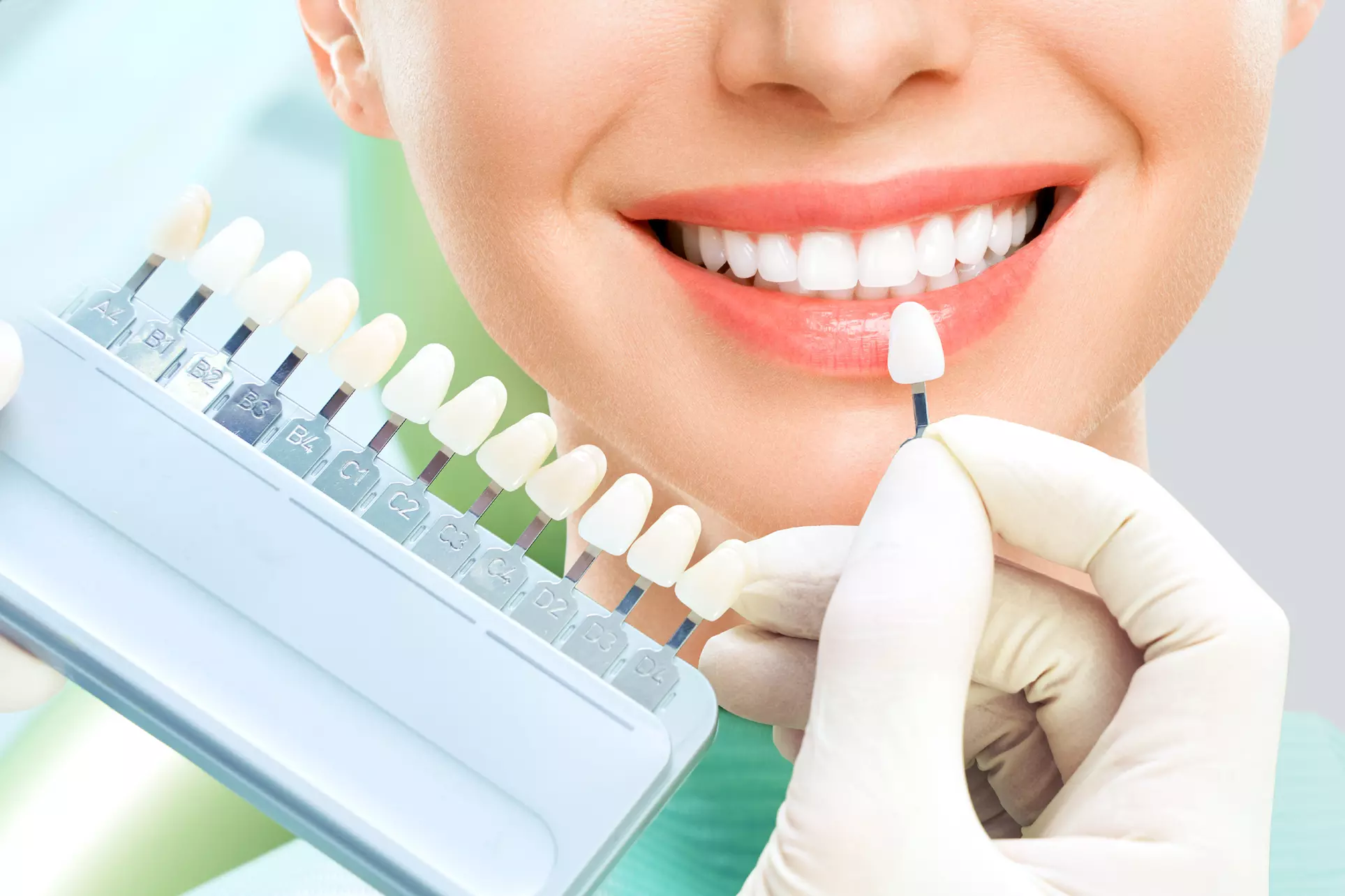 Teeth-Whitening Treatment at LaBelle MedSpa (Up to 64% Off). Two Options Available. - Primary Image